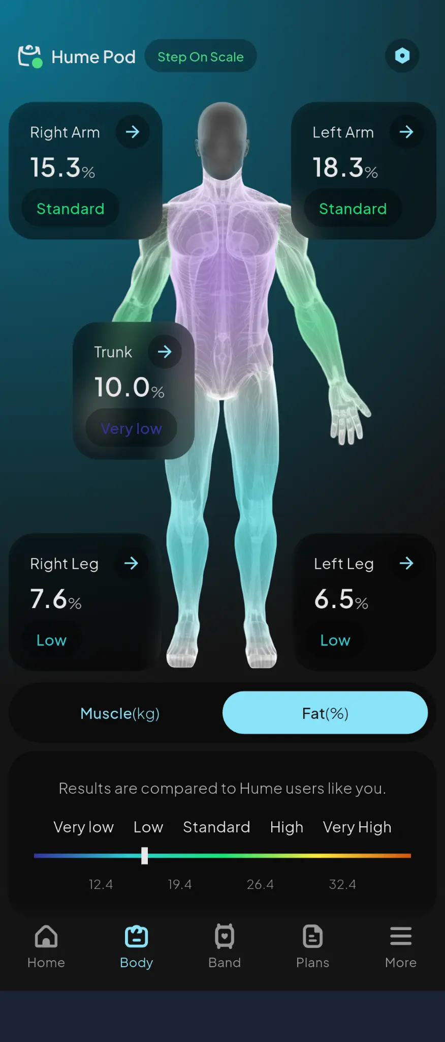 Ανάλυση λιπώδους μάζας ανά μέλος σώματος μέσω εφαρμογής Body Solutions για ακριβή αξιολόγηση σύστασης σώματος